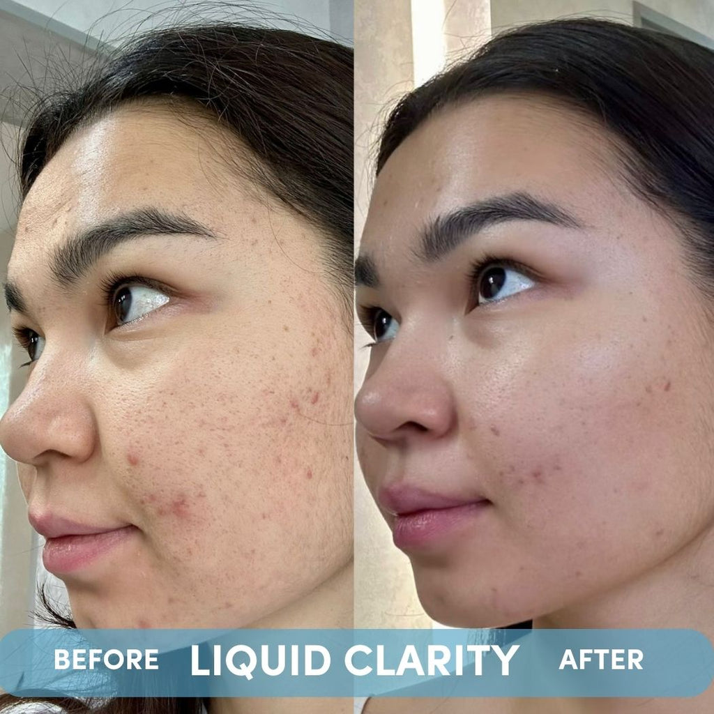 LIQUID CLARITY by PSA