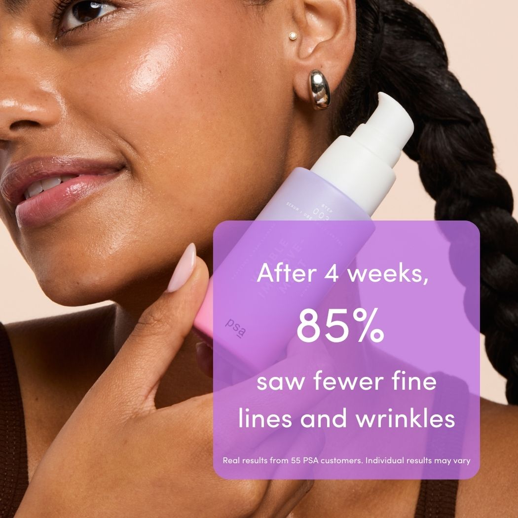 VISIBLE IMPROVEMENT by PSA