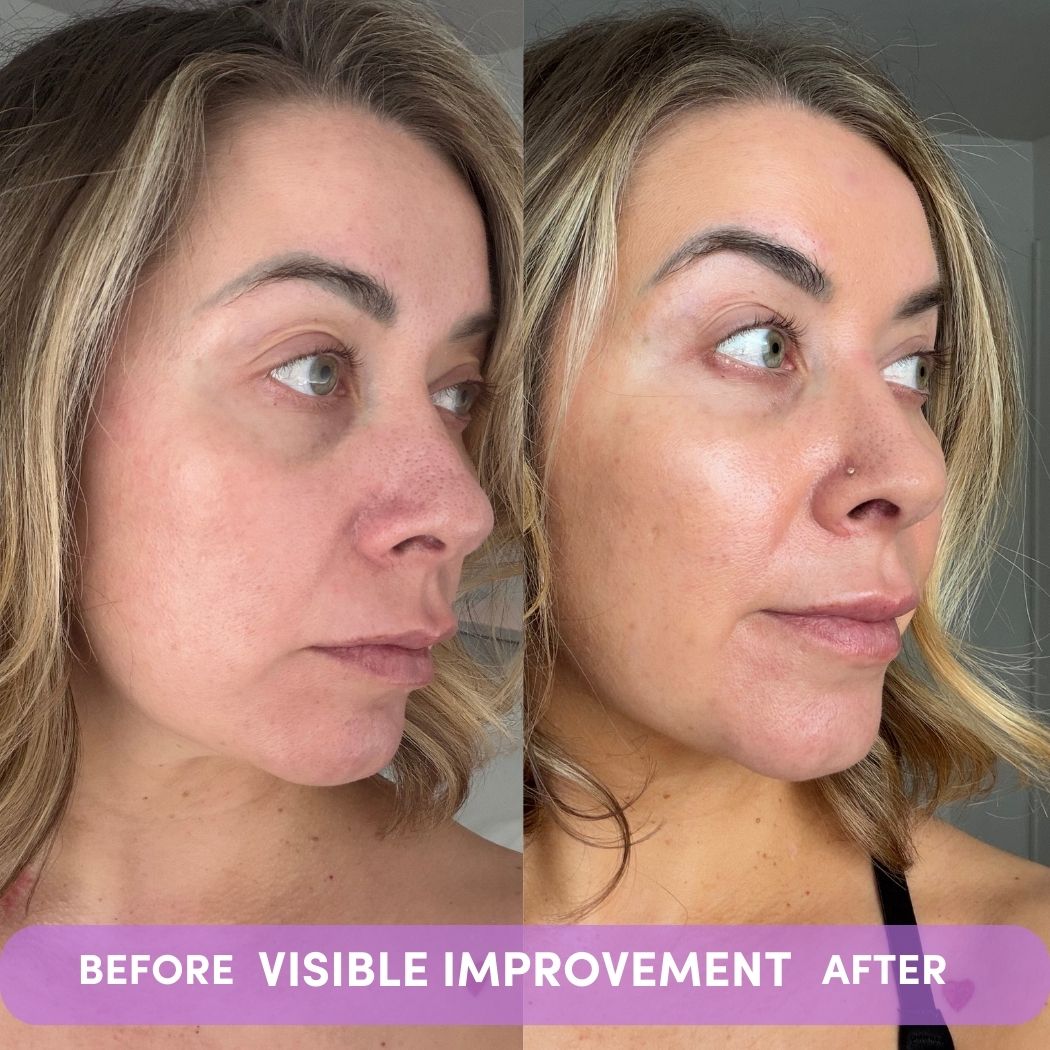 VISIBLE IMPROVEMENT by PSA